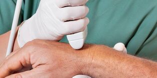 Arthritis als Ursache von Schmerzen in den Fingergelenken