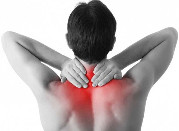 Nackenschmerzen können die Ursache für Osteochondrose sein. 