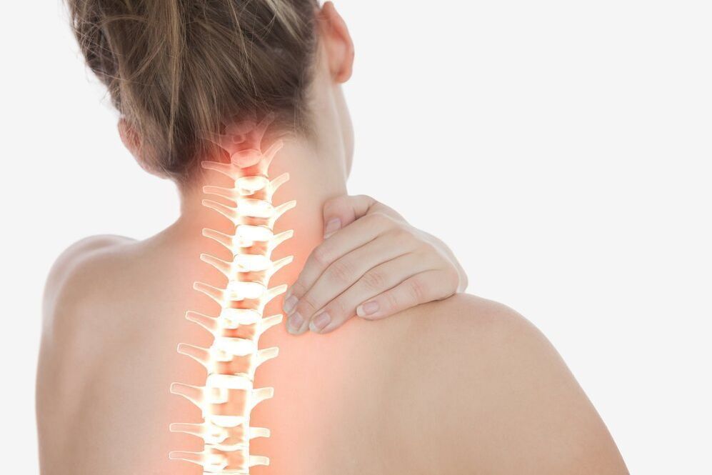 zervikale Osteochondrose und ihre Behandlung mit Übungen