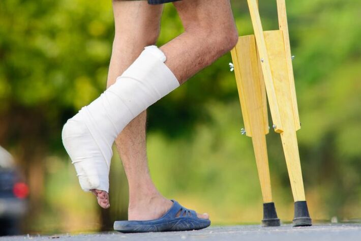 Knöchelverletzung als Ursache für Arthrose